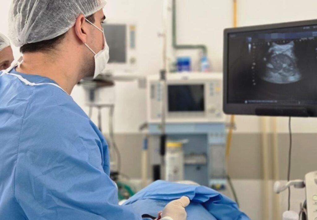 Biópsia transperineal revela câncer de próstata em 24h