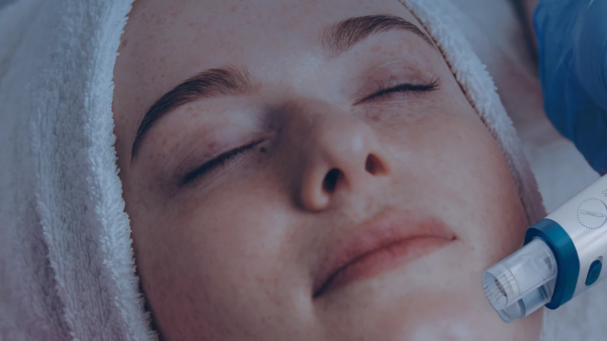 Técnica de microagulhamento ganha novas tecnologias em 2025